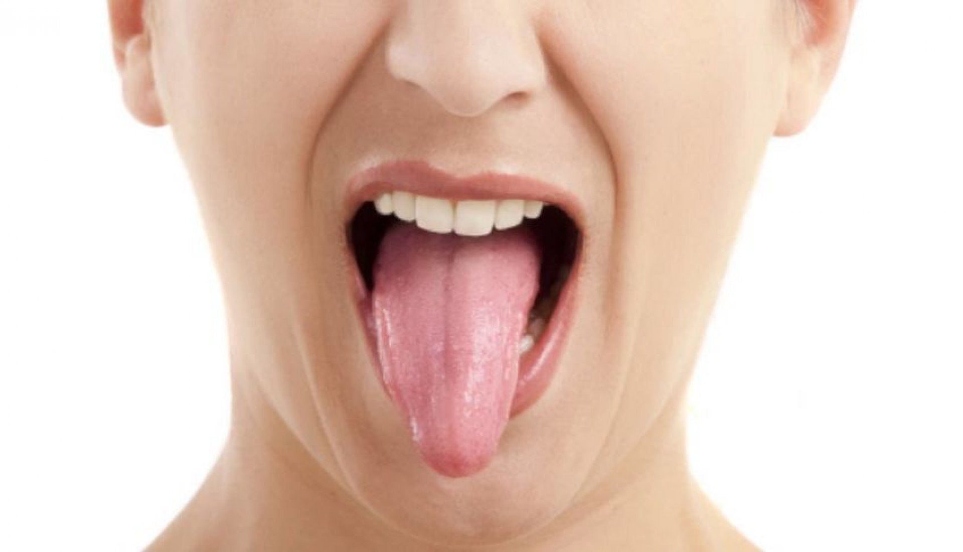 La misteriosa enfermedad que hace que la lengua te queme sin parar