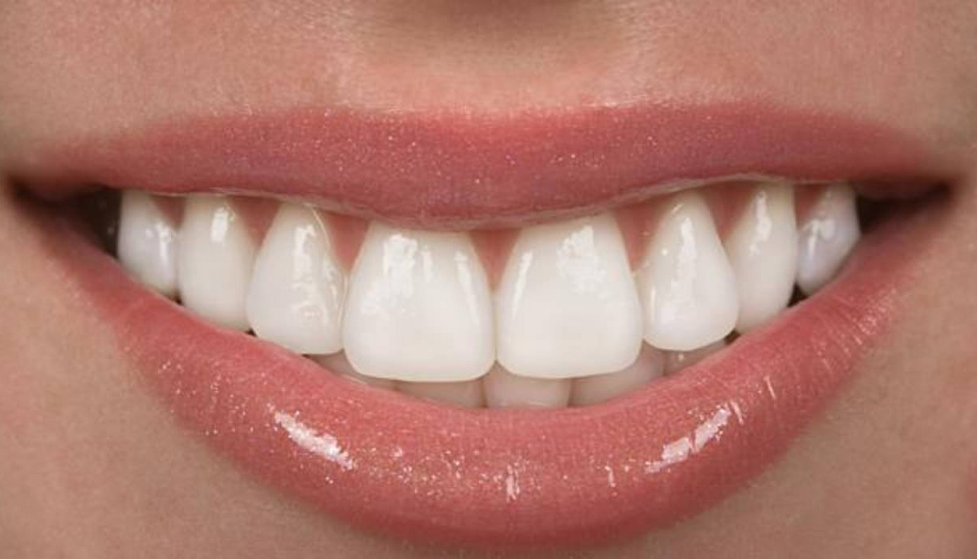 Cómo mantener tus dientes a salvo de caries